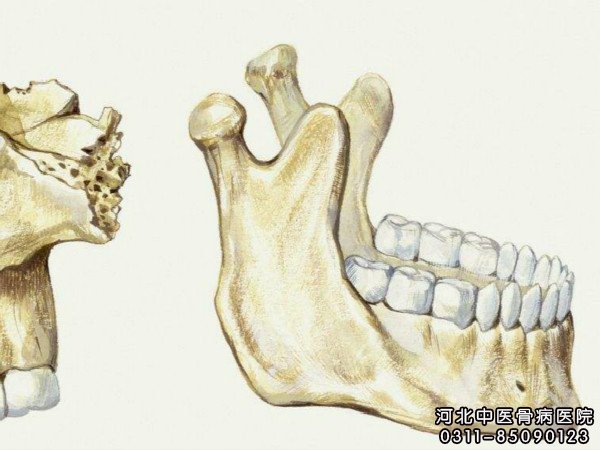 颌骨骨髓炎