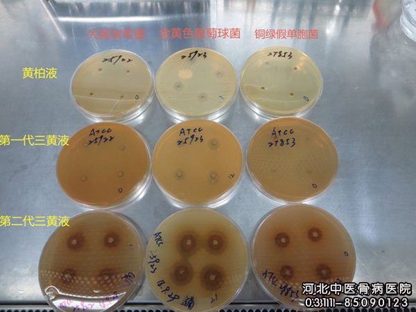 微生物药敏实验